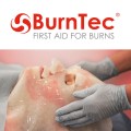 burntec-1.jpg